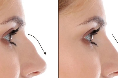 How the Best Septoplasty Surgeon in Dubai Ensures Optimal Outcomes
