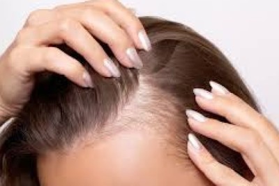 Rice Water for Curly Hair: Tame Frizz While Promoting Growth