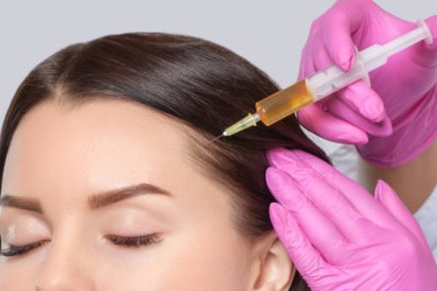 PRP Therapy for Thinning: Quick Sessions for Lasting Volume Gains