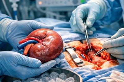 Early Signs of Kidney Stones You Shouldn’t Ignore