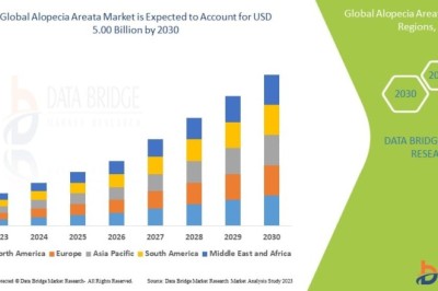 Alopecia Areata Market Sees Growth with Emerging Targeted Treatment Innovations