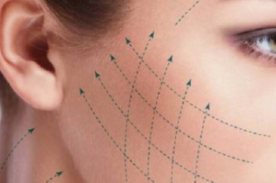 7 Key Benefits of Choosing Tensioning Threads Treatment For A Youthful Look