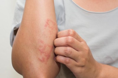 Top-Rated Allergy Specialist in Dubai – Book Your Consultation with Dr Mahesh Katre