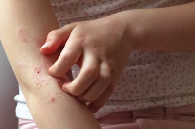 Fenbendazole Tablets for Humans – Treat Intestinal Parasites