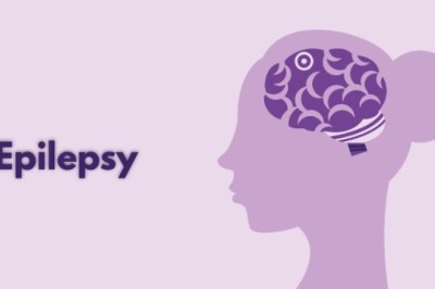 Epilepsy Relief: Lyrica 300mg Guide
