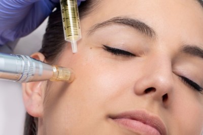 PRP Treatment for Face: Natural Anti-Aging with No Downtime