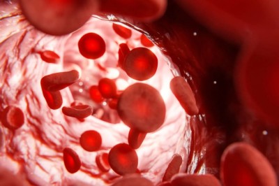 Lifestyle Changes to Manage High Cholesterolemia in Dubai