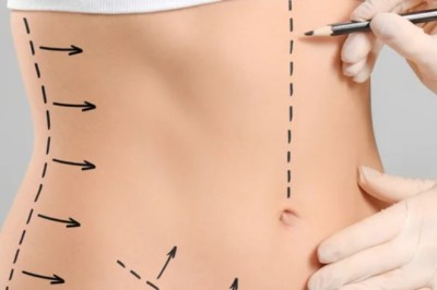 Tummy Tuck in Dubai – Safe and Effective Surgery
