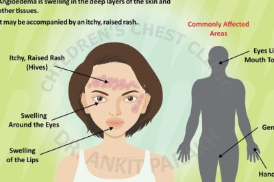 An Expert Guide to Swelling of Deeper Layers of Skin