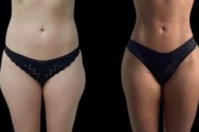 Where Science Meets Aesthetics – Best Aesthetic Clinic in Dubai