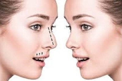 مراجعات المرضى بعد جراحة الأنف: قصص وتجارب حقيقية