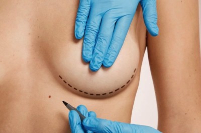 Combining Breast Lift in Dubai with Other Procedures