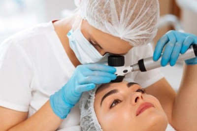 متى يجب استشارة طبيب الجلدية في حالات الصلع المبكر؟