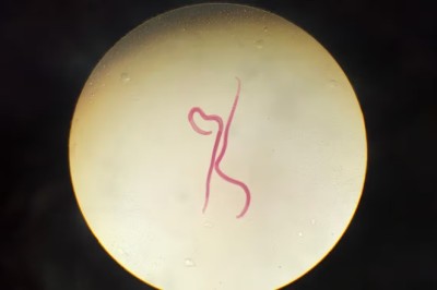 Natural Ways to Fight Off Worm Infections