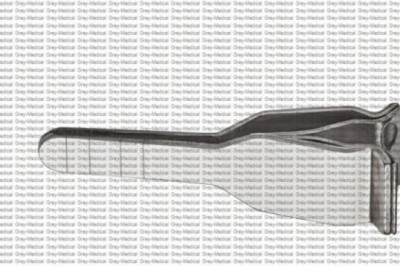 The Precision of Clamp Micro Surgical Instruments