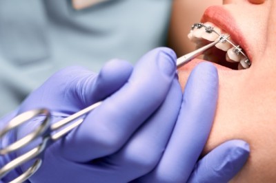 Orthodontic Dentistry in Dubai: Modern Braces and Aligners for Every Age