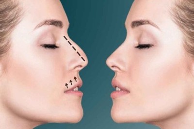 أفضل خيارات جراحة تجميل الأنف للحصول على شكل مثالي