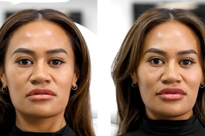 CO2 Laser in Manchester: Say Goodbye to Wrinkles