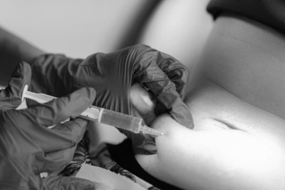 أفضل تقنيات حقن إذابة الدهون للحصول على قوام مثالي