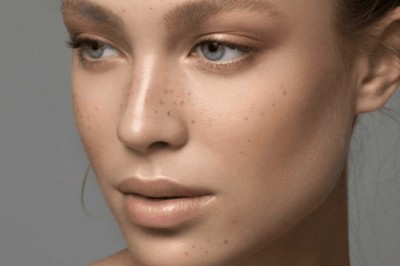 Eyelid Bag Surgery Dubai: Recovery and Swelling Timeline