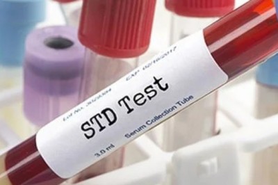 STD test singapore