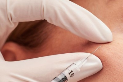 Dark Circle Under Eye Treatment in Dubai: Expert Advice for Brighter, Healthier Eyes