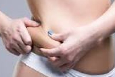 Liposuction in Dubai: Where Expertise Delivers Confidence