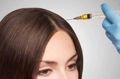 PRP Hair Treatment In Dubai And Hair Transplant In Dubai Solutions