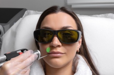 Minimize Fine Lines With CO2 Laser in Manchester