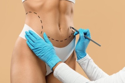 Mini Tummy Tuck Dubai: How It Differs from a Full Tummy Tuck