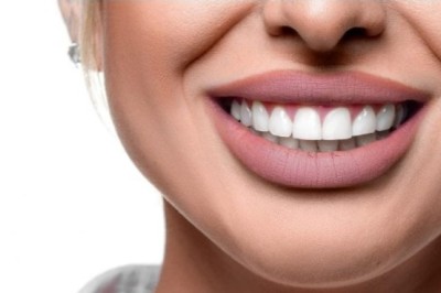 Hollywood Smile Makeover in Dubai: Get a Celebrity-Style Perfect Smile