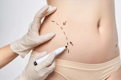 Body Contouring in Dubai: Cost, Benefits, and Results