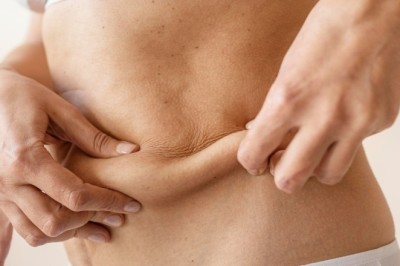 Best Vaser Liposuction Surgeons in Dubai Delivering Elite Aesthetic Care