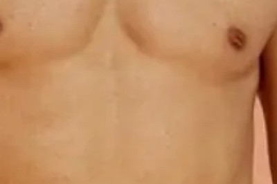 أحدث تقنيات شفط الدهون في جدة بنتائج فعالة وآمنة