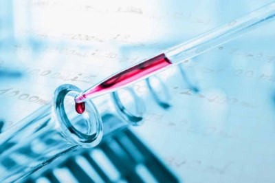 Hepatitis B Test: Early Detection and Prevention