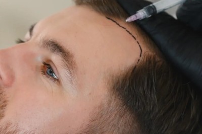 Hair Loss Treatment in Dubai: Proven Medical Solutions for Hair Thinning