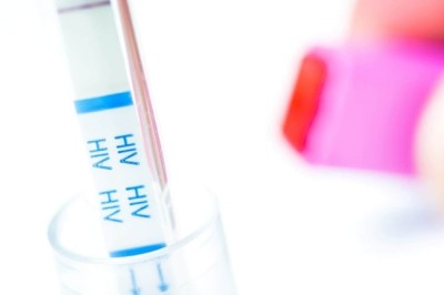 HIV Test in Dubai: A Complete Guide for First-Time Patients