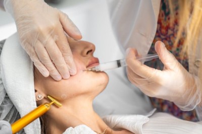 Cost of Sculptra Fillers in Dubai: Factors You Should Know