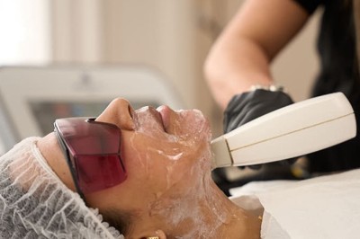 Laser For Pigmentation In London: Modern Laser Skin Therapy to Eliminate Dark Spots, Sun Damage, and Uneven Skin Tone
