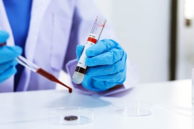 STD Screening Dubai: High-Risk Group Testing Services