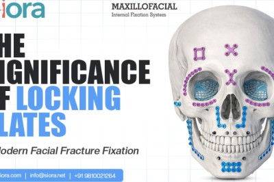 The Significance of Locking Plates in Modern Facial Fracture Fixation