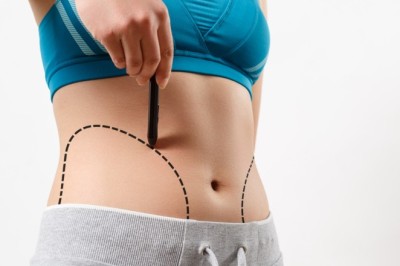 Best Liposuction Surgeons in Dubai for Customized Body Contouring Plans