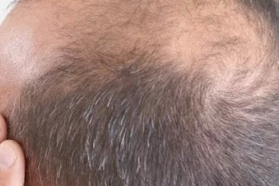 Discover G Cell Treatment in Dubai & Abu Dhabi | Glamorous Clinic in Dubai