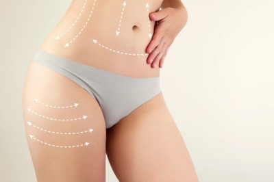 Your Road to Recovery After Liposuction in Dubai