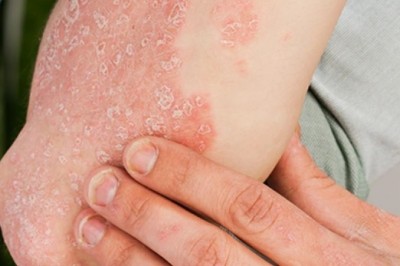 Why Your Current Body Wash Might Be the Issue