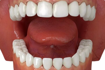 Dental Implants in Dubai: Tips for Long-Lasting Results