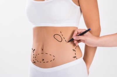 Get the Results You Desire with the Best Liposuction Surgeons in Dubai