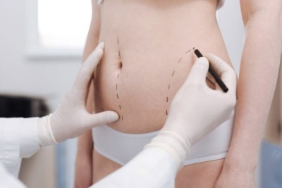 Best Liposuction Surgeons in Dubai: Crafting Beautiful Results