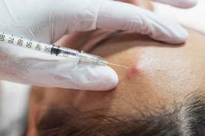 Joint & Muscle Steroid Injections in Dubai | Glamorous Clinic in Dubai