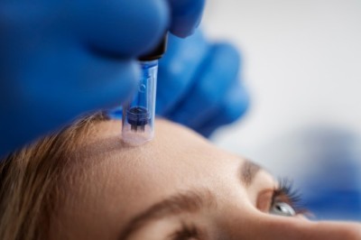 Does Skinpen Microneedling in Altrincham Hurt? What to Expect During Treatment